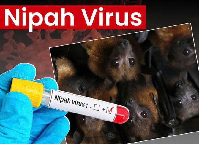 Dịch bệnh do virus Nipah và khuyến cáo của ngành Y tế- Ảnh 1.